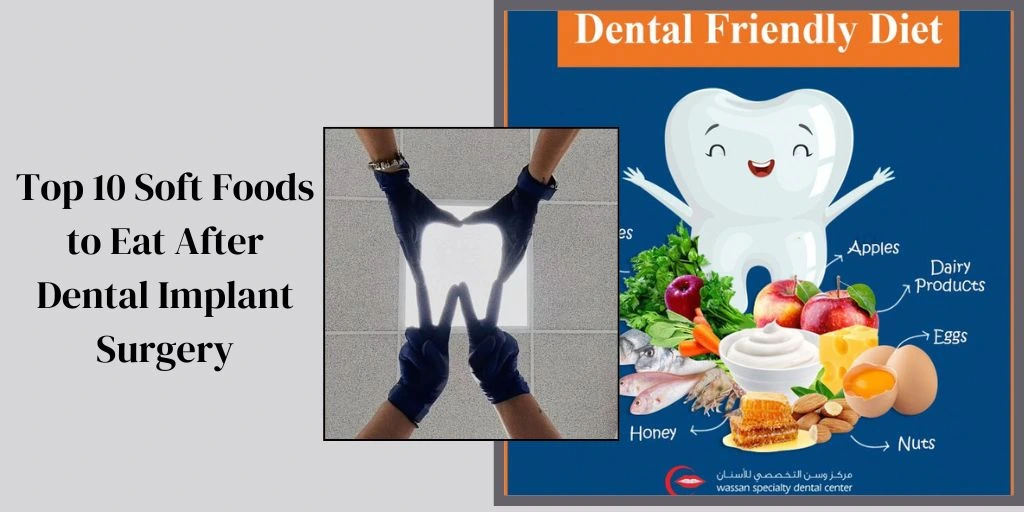 Best Foods After Dental Implant Surgery